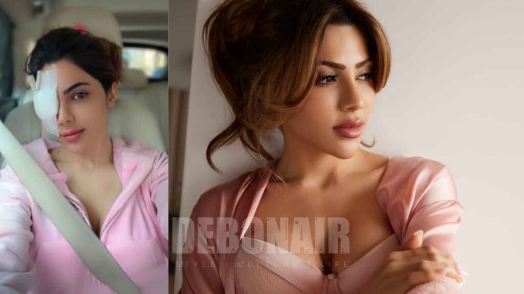 Nikki Tamboli eye surgery