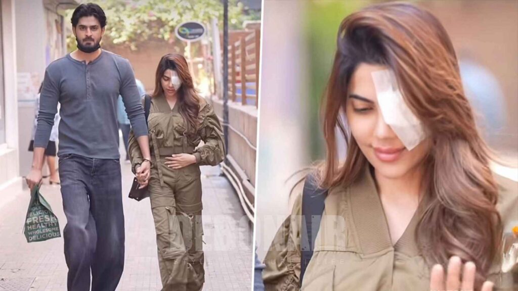 Nikki Tamboli eye surgery